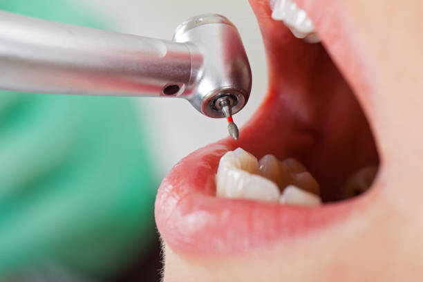 Best Emergency Treatment for Toothache in Quincy, IL